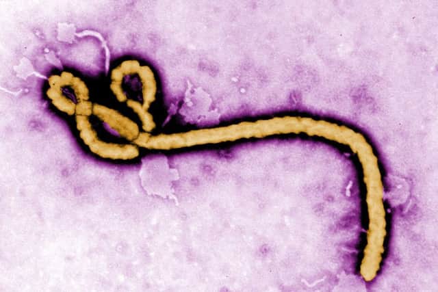 The Ebola virus.