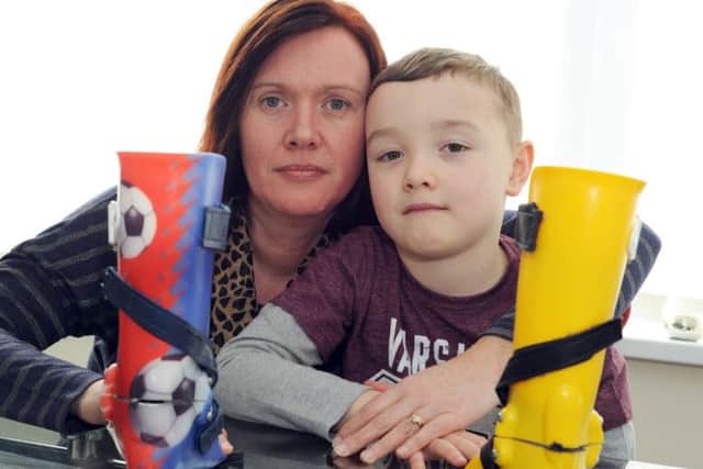 Logan Scothern and his mum Caroline, with his preferred patterned splints and the plain yellow ones that he now has to wear.