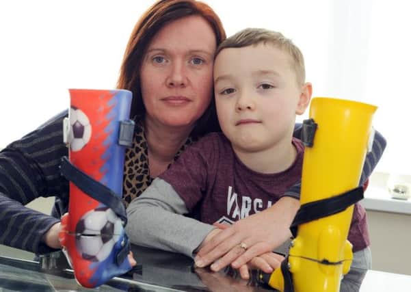 Logan Scothern and his mum Caroline, with his preferred patterned splints and the plain yellow ones that he now has to wear.