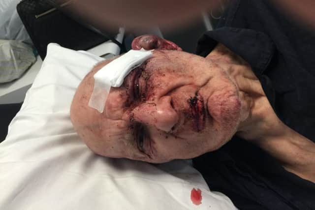 Mansfield pensioner Cyril Smith was seriously injured in an incident at the Parkside nursing home.