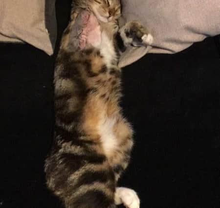 Tony had his leg amputated on Monday.