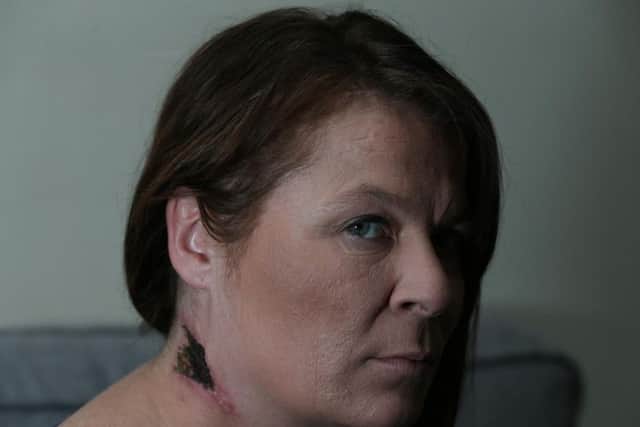Suzanne has been in hospital on numerous occasions since the attack.