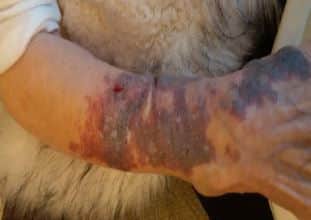 The injuries sustained by the elderly woman.