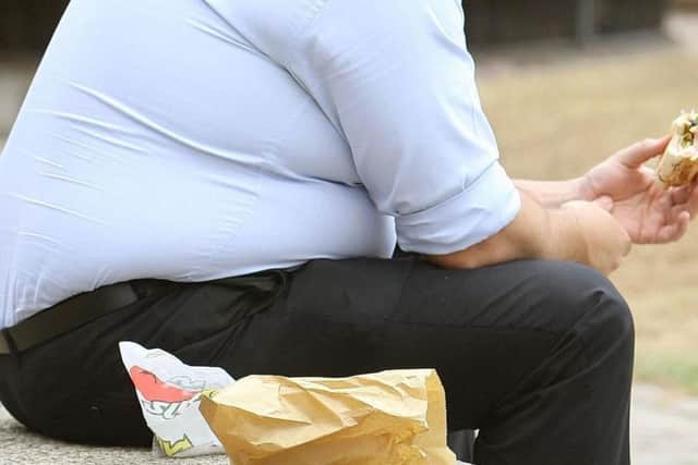Obesity