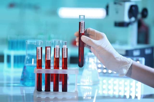 The test is able to detect five common types of cancer years before symptoms show (Photo: Shutterstock)