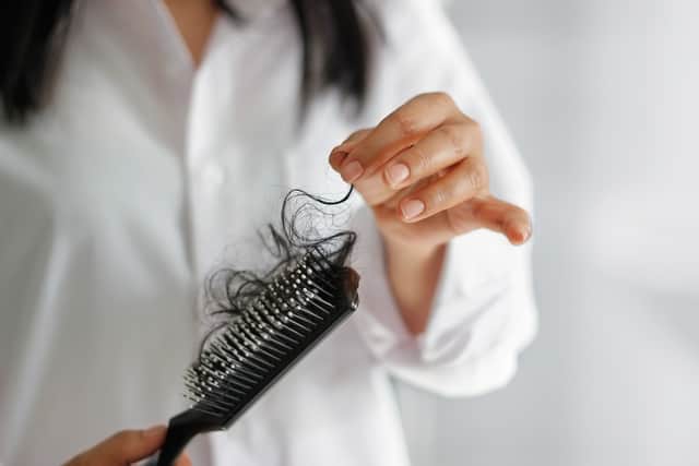 A new study has found that almost a quarter of Covid-19 patients suffer from hair loss within the first six months of being infected, with women more at risk (Photo: Shutterstock)