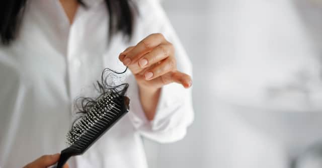 A new study has found that almost a quarter of Covid-19 patients suffer from hair loss within the first six months of being infected, with women more at risk (Photo: Shutterstock)